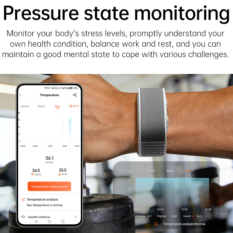 VWAR LOOP X ECG Smart Bracelet - Xbody Health & Wellness Functional Integrative Medicine Office & Medical Spa review and price